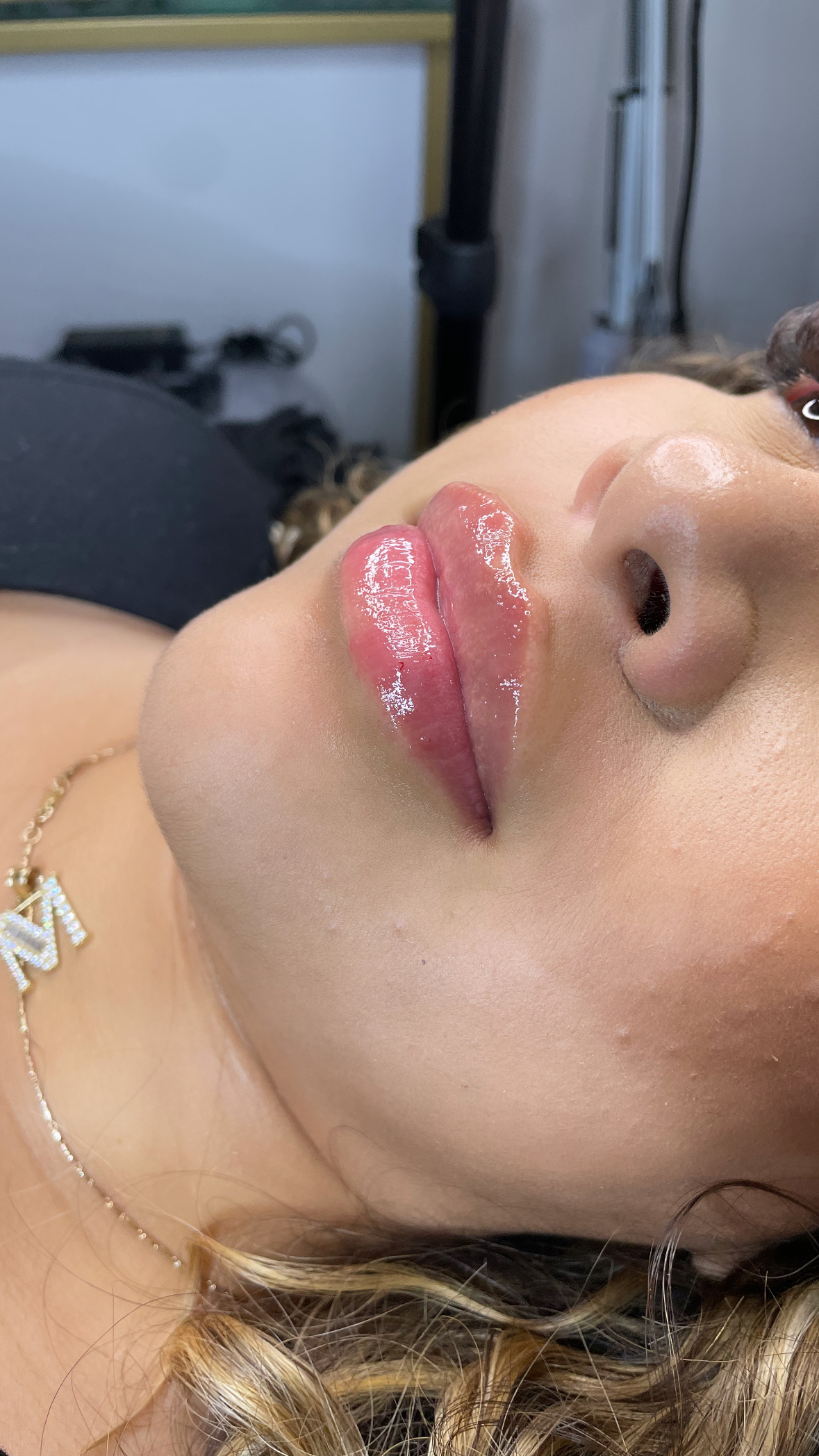 Lip Enhancement — Hers & Her Beauty Bar